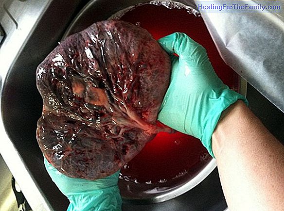 The placenta and its problems during pregnancy