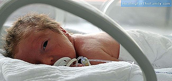 Early stimulation in premature babies