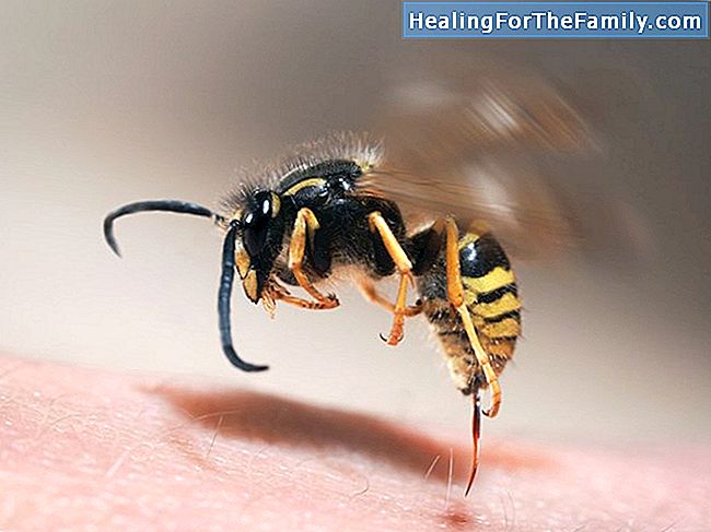 Wie Bienenstiche oder Wespe bei Kindern heilen