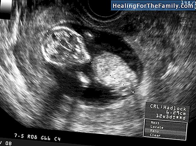 18 Wochen der Schwangerschaft