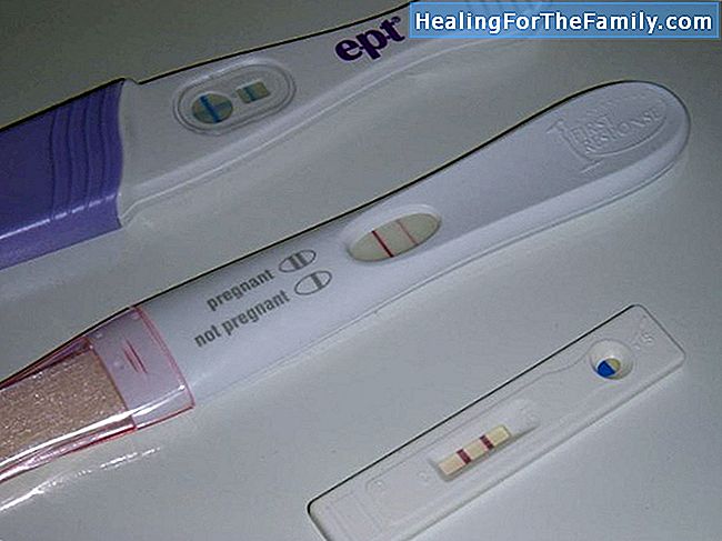 O'Sullivan Test oder Test schwanger Glukose