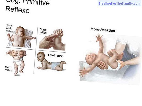 10 Basic reflexes of the newborn baby