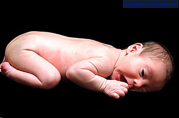 Birth spots on babies
