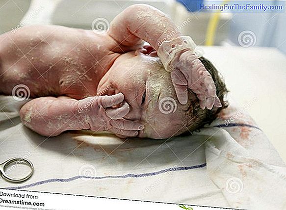What is the vernix caseosa of the newborn