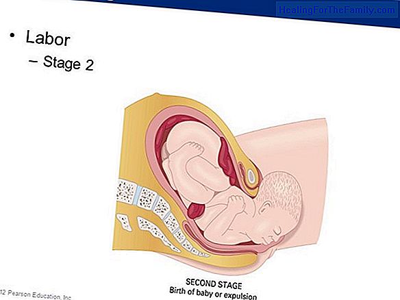 Stages of labor: dilation
