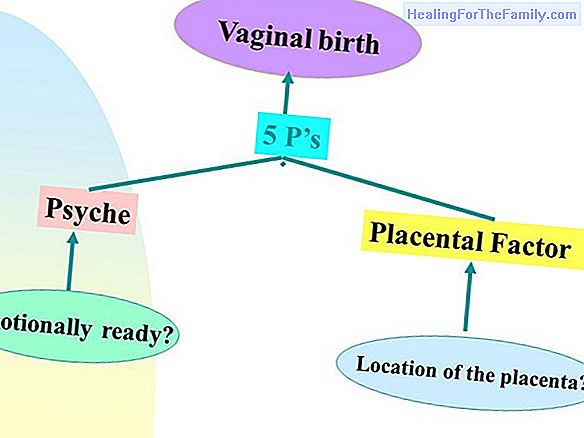 Stages of labor. Dilation, expulsion and delivery of the baby