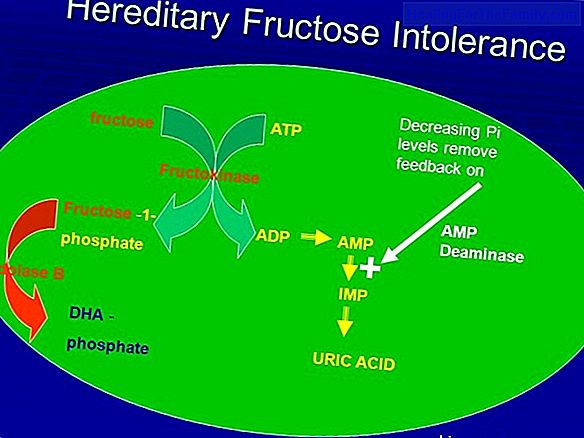 Fructose intolerance in children