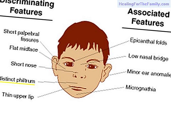 Defiant defiant disorder in children, causes, symptoms and diagnosis