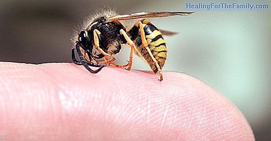 How to cure bee or wasp stings in children