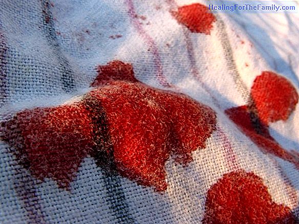 How to remove grease stains from children's clothing