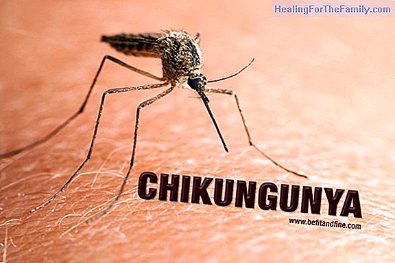 How to treat mosquito and horsefly bites in children