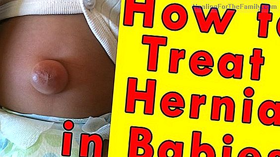 Inguinal hernia in babies