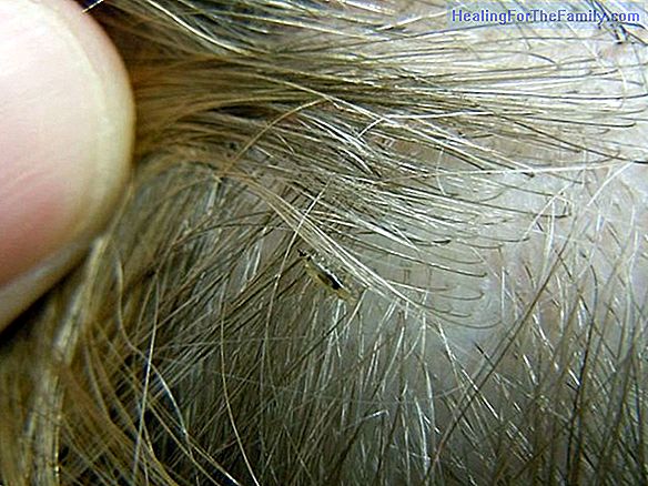 Remove lice from children's hair step by step