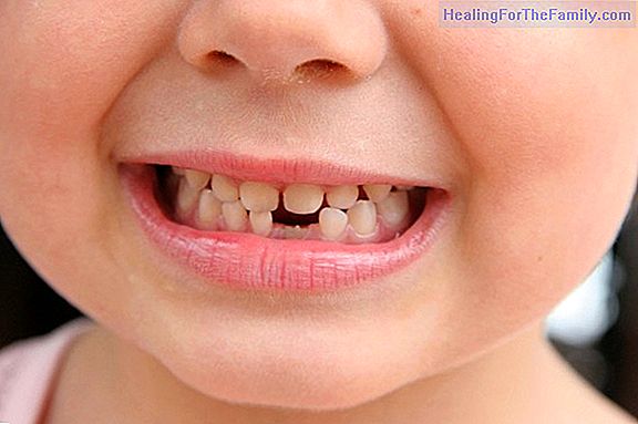 Root canals in children's teeth