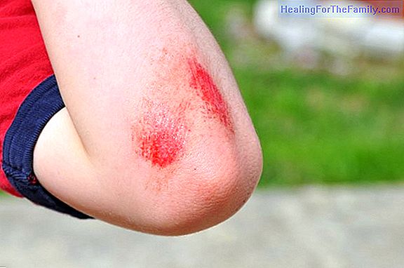 Stitches in children's wounds