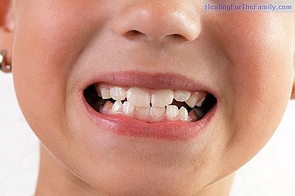 What consequences can a blow on a baby tooth have?