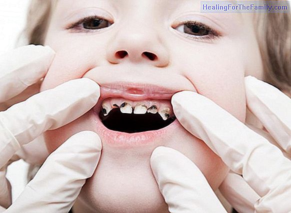 What is the crossbite and how does it affect children?