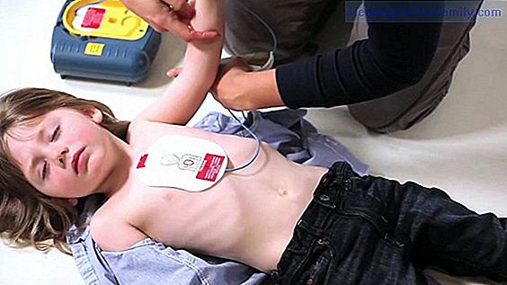 What is a defibrillator and how is it used in children?