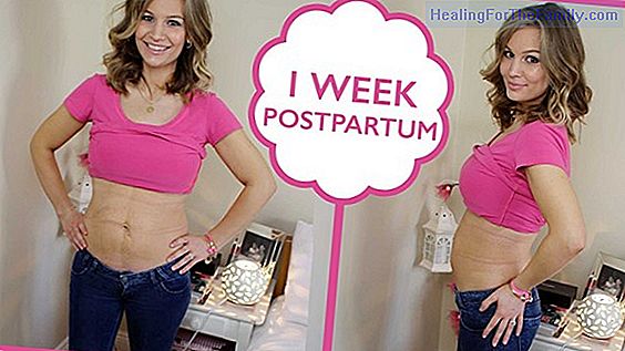 8 Weeks of pregnancy