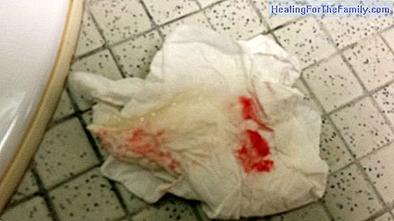Bleeding due to implantation in pregnancy