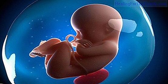 Excess of amniotic fluid in pregnancy