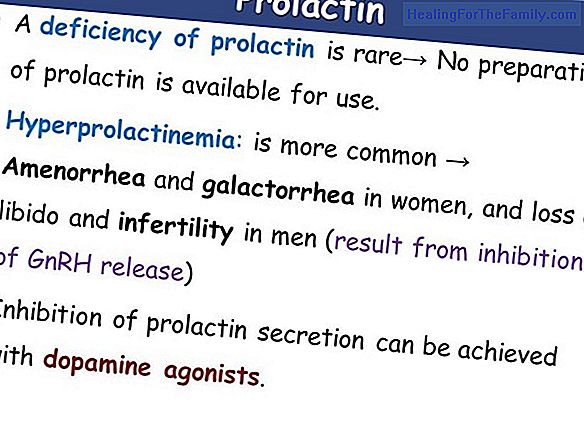 High prolactin or hyperprolactinemia. Infertility in women