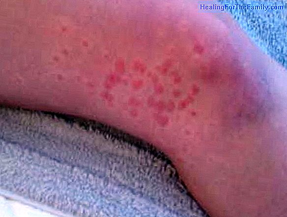 Itchy skin during pregnancy