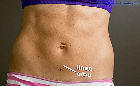Line alba in pregnancy, what is it?