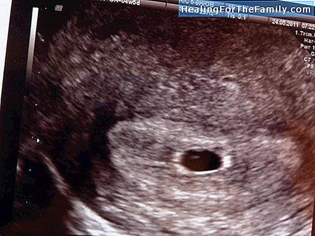 Ensimmäinen raskaus ultraääni