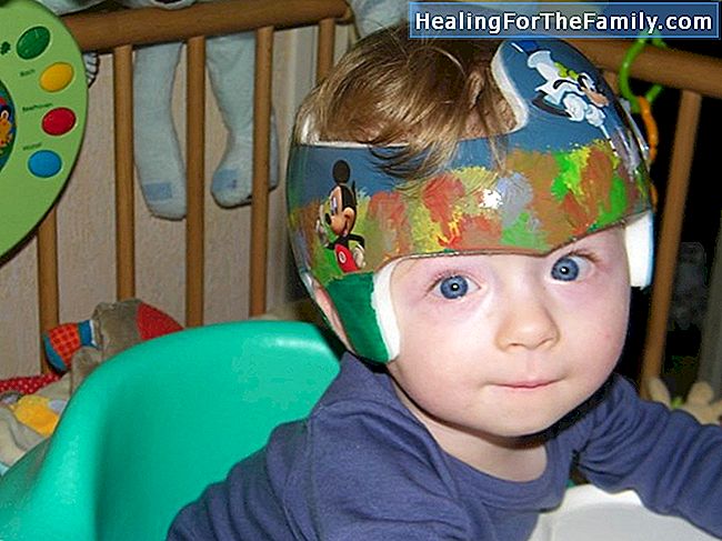 Bébés avec une tête aplatie. Plagiocéphalie chez les nourrissons