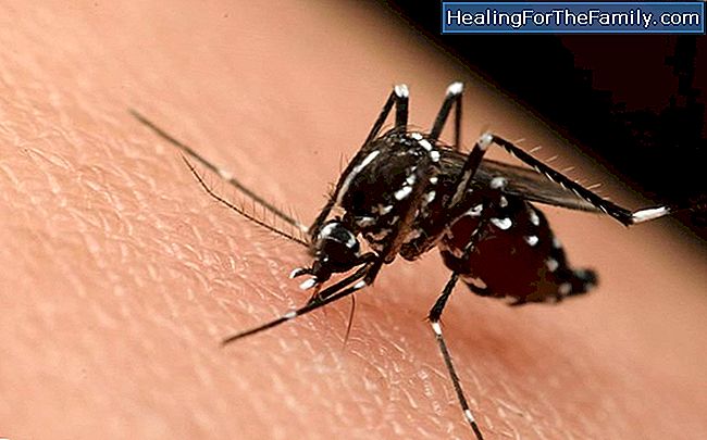 Virus Zika provoque microcéphalie nouveau-né