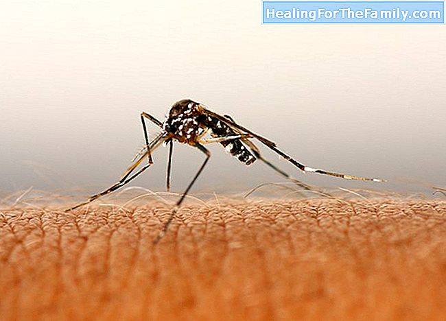 Virus Zika. Résoudre vos questions sur le virus Zika