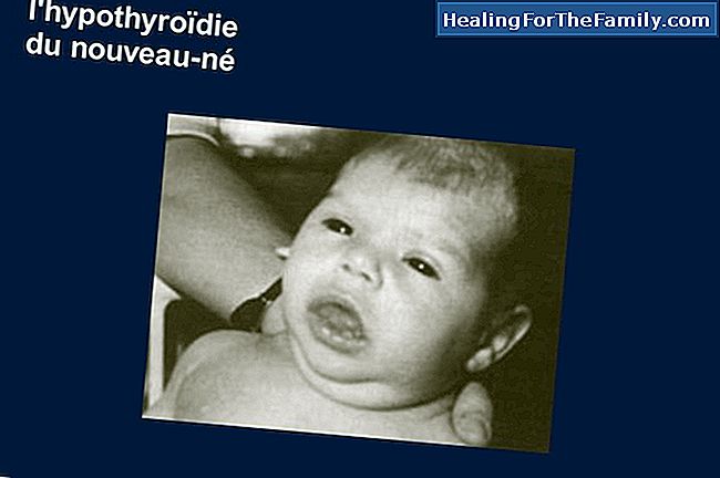 Hypothyroïdie chez le fœtus