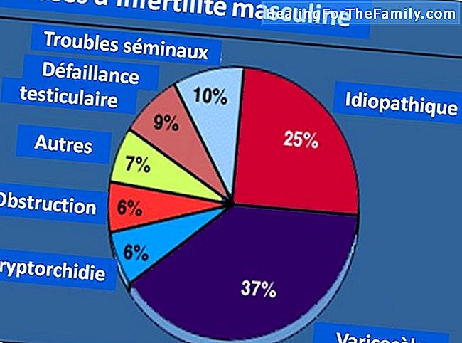 La stérilité et l'infertilité masculine et féminine