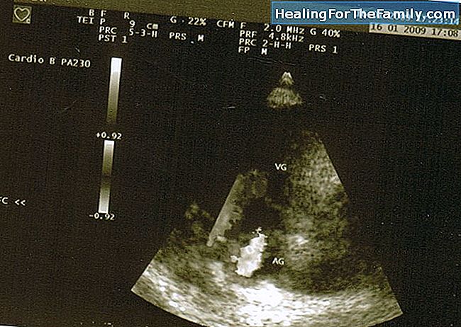 Quel est l'écho Doppler et ce qui est dans la grossesse