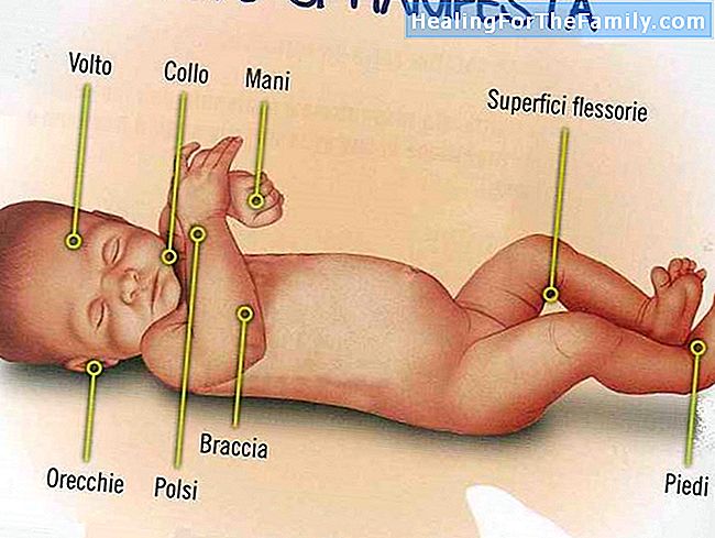 Crosta lattea nei neonati: Domande e risposte