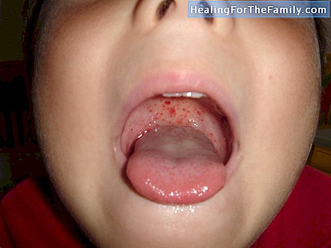 Infezioni respiratorie nei neonati e nei bambini