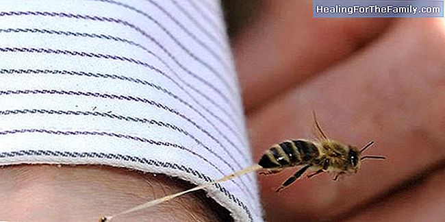 Trucchi per il trattamento di una puntura di vespa nei bambini