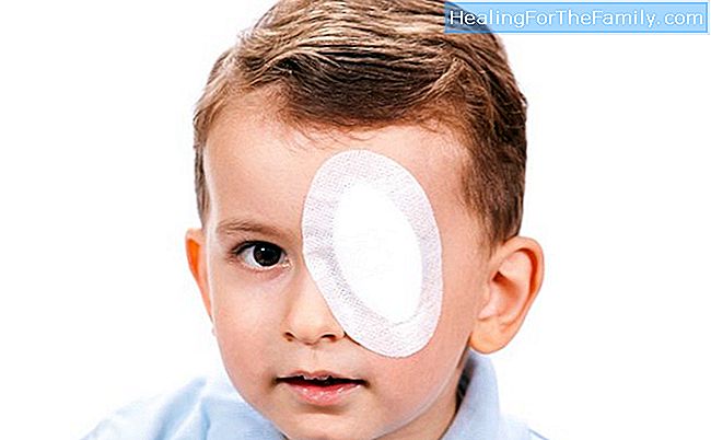 Kinderen met amblyopie of lui oog