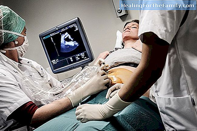 Medische tests en analyses in de zwangerschap