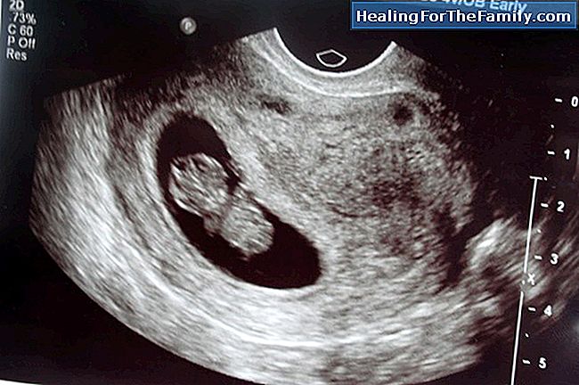 De eerste paar maanden van de zwangerschap