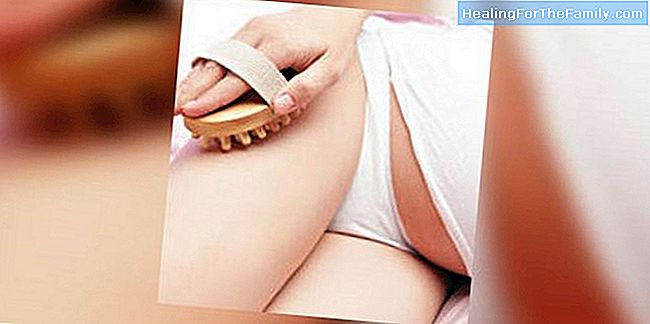 Tips om cellulitis in zwangerschap te voorkomen