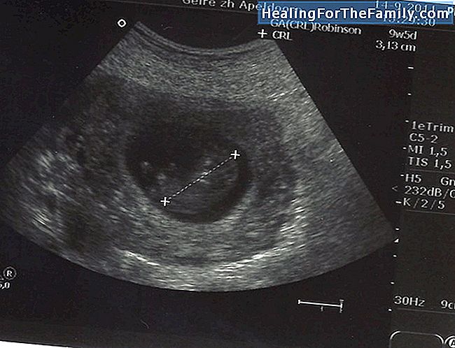 Echografie in het eerste trimester van de zwangerschap
