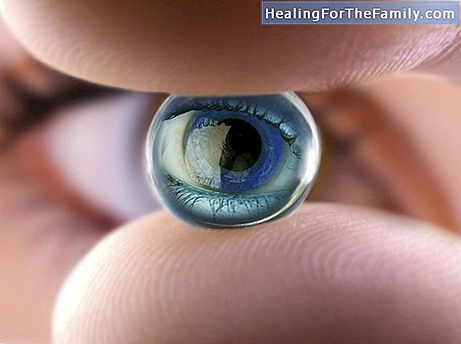 Kontaktlinser for å korrigere nærsynthet hos barn