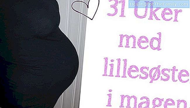 31 Uker gravid