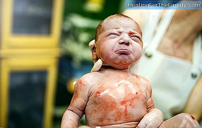Bebês nascidos com retorno do cordão umbilical