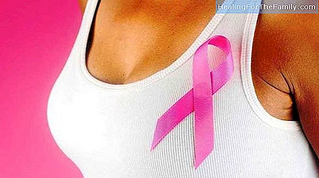 10 Coisas que você deve saber sobre câncer de mama