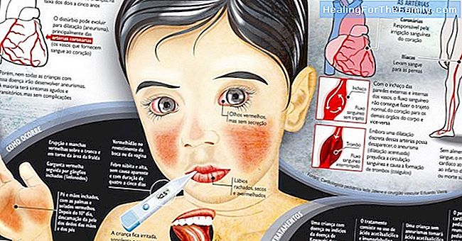 Doenças comuns da infância causadas por bactérias