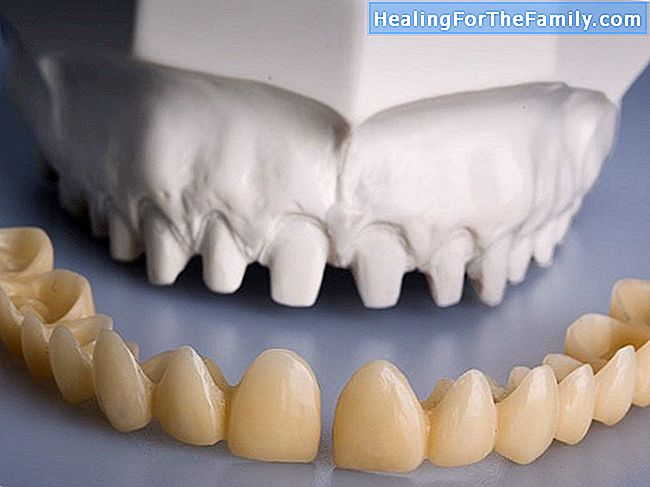 Endodontia nos dentes das crianças