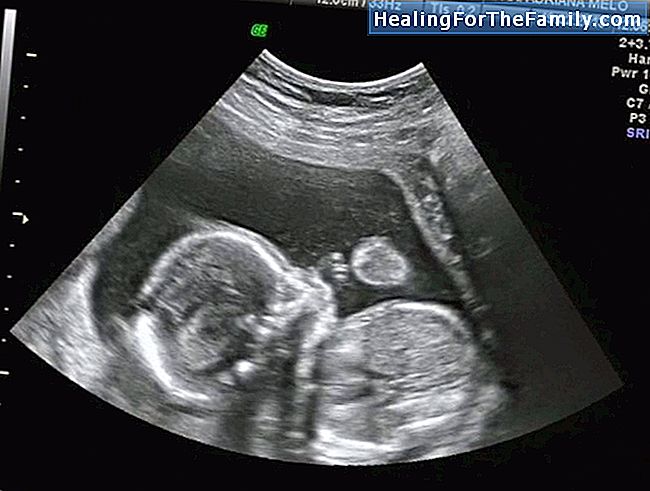O bebê de 16 meses de idade. Desenvolvimento do bebê mês após mês